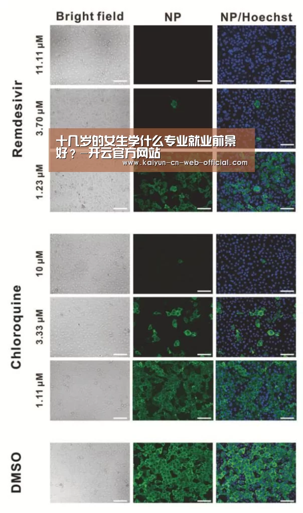 十几岁的女生学什么专业就业前景好?-开云官方网站(图3) 开云体育